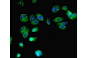 Immunofluorescent analysis of MCF-7 cells using ABIN7153163 at dilution of 1:100 and Alexa Fluor 488-congugated AffiniPure Goat Anti-Rabbit IgG(H+L) (FFAR2 抗体  (AA 277-330))