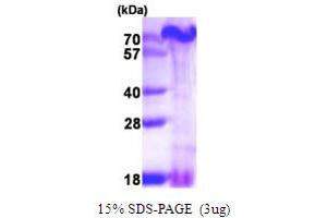 SDS-PAGE (SDS) image for PAXIP1 Associated Glutamate-Rich Protein 1 (PAGR1) (AA 1-254) protein (His tag) (ABIN5780113) (PAGR1 Protein (AA 1-254) (His tag))