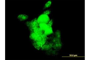 Immunofluorescence of monoclonal antibody to SMOC1 on A-431 cell. (SMOC1 抗体  (AA 150-221))