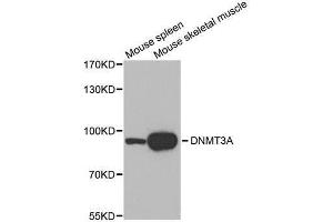 Western blot analysis of extracts of various tissues, using DNMT3A antibody. (DNMT3A 抗体)