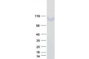 Validation with Western Blot