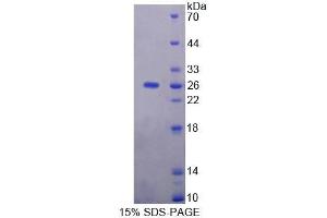 SDS-PAGE analysis of Human NIN Protein. (Ninein 蛋白)