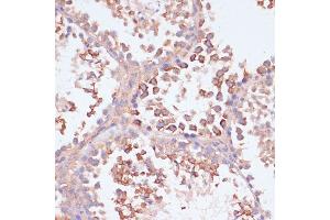 Immunohistochemistry of paraffin-embedded mouse testis using MRPL41 antibody (ABIN7268572) at dilution of 1:100 (40x lens). (MRPL41 抗体  (AA 1-137))