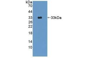 Detection of Recombinant OAS1, Rat using Polyclonal Antibody to 2',5'-Oligoadenylate Synthetase 1 (OAS1) (OAS1 抗体  (AA 139-358))