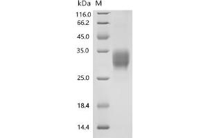 CD8a Molecule (CD8A) (AA 28-196) protein (His tag)