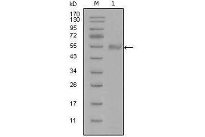 Western blot analysis using SYT1 mouse mAb against truncated Trx-SYT1 recombinant protein (1). (SYT1 抗体)