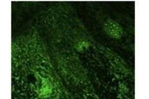 Anti-Rab9b Ab at 1/500 dilution, lysates at 100 µg per Iane, rabbit polyclonal to goat lµg (HR? (RAB28 抗体  (C-Term))