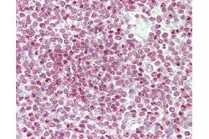 Anti-CENPW / C6orf173 antibody IHC staining of human spleen. (CENPW 抗体  (N-Term))
