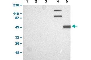 Western Blot analysis of (1) human cell line RT-4, (2) human cell line U-251MG sp, (3) human plasma (IgG/HSA depleted), (4) human liver tissue, and (5) human tonsil tissue. (CAPN10 抗体  (AA 146-245))