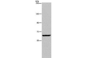 Western Blot analysis of Hela cell using IVL Polyclonal Antibody at dilution of 1:200 (Involucrin 抗体)