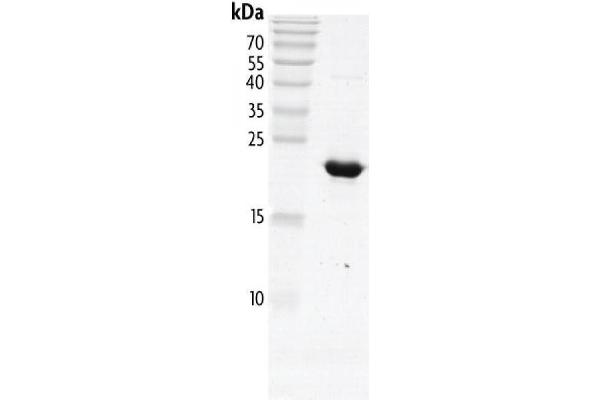 Polybromo 1 Protein (PBRM1) (AA 613-734) (His tag,DYKDDDDK Tag)