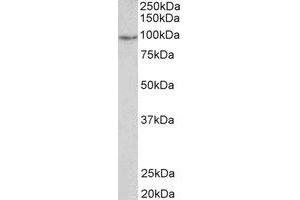 Western Blotting (WB) image for anti-phosphodiesterase 4B, cAMP-Specific (PDE4B) (C-Term) antibody (ABIN2464994) (PDE4B 抗体  (C-Term))