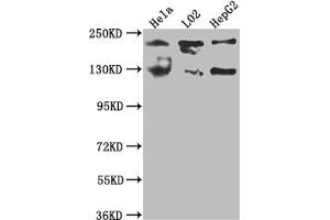 Western Blot Positive WB detected in: Hela whole cell lysate, L02 whole cell lysate, HepG2 whole cell lysate All lanes: MGEA5 antibody at 1:1000 Secondary Goat polyclonal to rabbit IgG at 1/50000 dilution Predicted band size: 103, 96, 77, 97 kDa Observed band size: 130 kDa (Recombinant MGEA5 抗体)