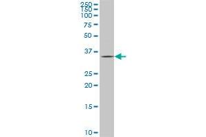 HHEX monoclonal antibody (M02), clone 1A5. (HHEX 抗体  (AA 1-270))