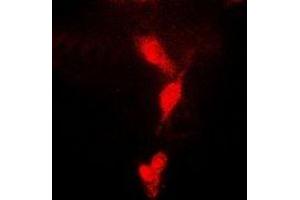Immunofluorescent analysis of CDC34B staining in MCF7 cells. (UBE2R2 抗体)