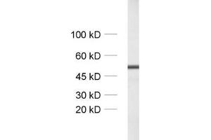dilution: 1 : 1000, sample: unboiled synaptic membrane fraction of rat brain (LP1) (GABRA1 抗体  (AA 28-43))