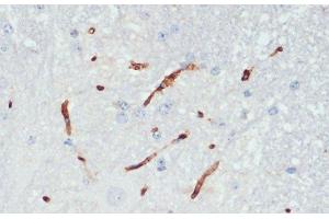 Immunohistochemistry of paraffin-embedded Mouse spinal cord using Phospho-eNOS(S1177) Polyclonal Antibody at dilution of 1:200 (40x lens). (ENOS 抗体  (pSer1177))