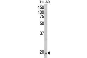 Western blot analysis of NDUFS4 Antibody (C-term) in HL-60 cell line lysates (35ug/lane). (NDUFS4 抗体  (C-Term))