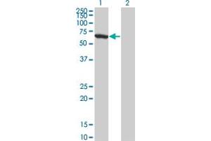 Western Blot analysis of WDR20 expression in transfected 293T cell line by WDR20 monoclonal antibody (M01), clone 1D10. (WDR20 抗体  (AA 1-569))