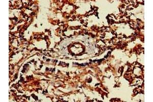 Immunohistochemistry of paraffin-embedded human lung tissue using ABIN7147067 at dilution of 1:100 (Caveolin 2 抗体  (AA 3-64))