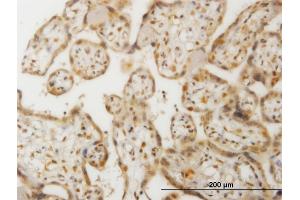 Immunoperoxidase of monoclonal antibody to CHEK2 on formalin-fixed paraffin-embedded human placenta. (CHEK2 抗体  (AA 1-543))