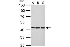WB Image Cytokeratin 14 antibody detects KRT14 protein by Western blot analysis. (KRT14 抗体)