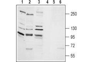 Western Blotting (WB) image for anti-Transient Receptor Potential Cation Channel, Subfamily M, Member 2 (TRPM2) (AA 105-120), (Intracellular) antibody (ABIN7043829)