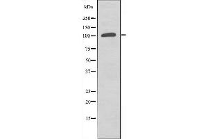 Western blot analysis of extracts from COLO205 cells, using ST5 antibody. (ST5 抗体  (Internal Region))