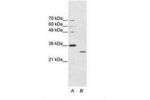 Image no. 1 for anti-ATPase, Cu++ Transporting, alpha Polypeptide (ATP7A) (C-Term) antibody (ABIN203040) (ATP7A 抗体  (C-Term))
