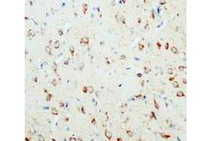 Immunohistochemical analysis of paraffin-embedded rat brain sections, stain NGF in cytoplasm DAB chromogenic reaction. (Nerve Growth Factor 抗体  (C-Term))
