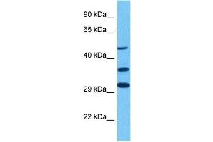 Host:  Rabbit  Target Name:  GLIS3  Sample Tissue:  Human 293T Whole Cell  Antibody Dilution:  1ug/ml (GLIS3 抗体  (C-Term))