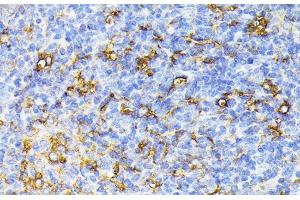 Immunohistochemistry of paraffin-embedded Mouse spleen using VEGF Receptor 1 Polyclonal Antibody at dilution of 1:100 (40x lens).