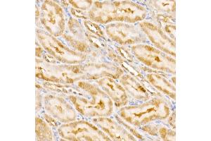 Immunohistochemistry of paraffin-embedded rat kidney using GPS1 Rabbit pAb (ABIN6127934, ABIN6141361, ABIN6141362 and ABIN6222653) at dilution of 1:250 (40x lens). (GPS1 抗体  (AA 258-527))