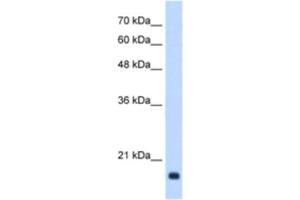 Western Blotting (WB) image for anti-Growth Arrest and DNA-Damage-Inducible, beta (GADD45B) antibody (ABIN2463174) (GADD45B 抗体)