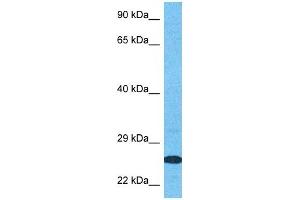 Host:  Rabbit  Target Name:  SPIT2  Sample Type:  MCF7 Whole Cell lysates  Antibody Dilution:  1. (SPIT2 抗体  (Middle Region))