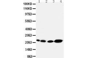 Anti-Caveolin-2 antibody, Western blotting Lane 1: Rat Heart Tissue Lysate Lane 2: Rat lung Tissue Lysate Lane 3: HELA Cell Lysate Lane 4: A431 Cell Lysate (Caveolin 2 抗体  (N-Term))