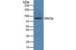 Detection of Recombinant GRIN2B, Human using Polyclonal Antibody to Glutamate Receptor, Ionotropic, N-Methyl-D-Aspartate 2B (GRIN2B) (GRIN2B 抗体  (AA 35-557))