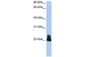 RHOD antibody used at 1 ug/ml to detect target protein. (RHOD 抗体  (N-Term))