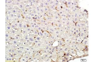 Formalin-fixed and paraffin embedded rat liver labeled with Anti-CD209 Polyclonal Antibody, Unconjugated (ABIN678893) at 1:200 followed by conjugation to the secondary antibody and DAB staining (DC-SIGN/CD209 抗体  (AA 81-180))
