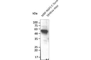Western Blotting (WB) image for anti-SARS-CoV-2 Papain-Like Protease (NSP3) (C-Term) antibody (ABIN7272998) (SARS-CoV-2 NSP3 抗体  (C-Term))