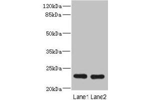 Western blot All lanes: RAB17 antibody at 3. (RAB17 抗体  (AA 1-212))