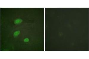 Immunofluorescence (IF) image for anti-HIR Histone Cell Cycle Regulation Defective Homolog A (HIRA) (AA 521-570), (pThr555) antibody (ABIN1531652)