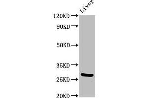 Western Blot Positive WB detected in: Mouse liver tissue All lanes: PIK3IP1 antibody at 7 μg/mL Secondary Goat polyclonal to rabbit IgG at 1/50000 dilution Predicted band size: 29, 26, 12, 19, 20 kDa Observed band size: 29 kDa (PIK3IP1 抗体  (AA 22-168))