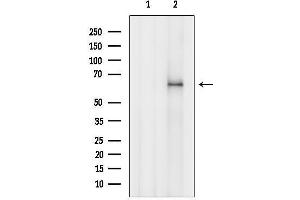 anti-Acyl-CoA Dehydrogenase Family, Member 11 (ACAD11) (Internal Region) antibody