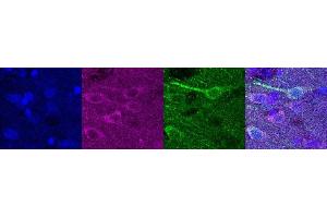 Immunohistochemistry (IHC) image for anti-Ubiquitin Carboxyl-terminal Esterase L1 (Ubiquitin Thiolesterase) (UCHL1) antibody (ABIN7456137) (UCHL1 抗体)