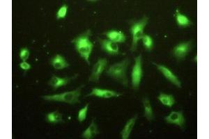 Detection of F13A1 in A549 cells using Polyclonal Antibody to Coagulation Factor XIII A1 Polypeptide (F13A1) (F13A1 抗体  (AA 107-345))