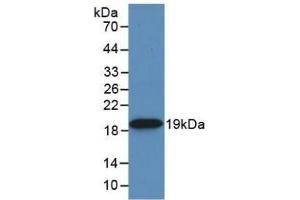 Detection of Recombinant HSPb6, Rat using Monoclonal Antibody to Heat Shock Protein Beta 6 (HSPb6) (HSPB6 抗体  (AA 1-162))
