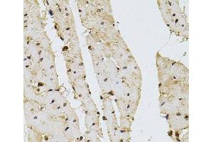 Immunohistochemistry of paraffin-embedded Rat heart using PPP2R5C Polyclonal Antibody at dilution of 1:100 (40x lens). (PPP2R5C 抗体)