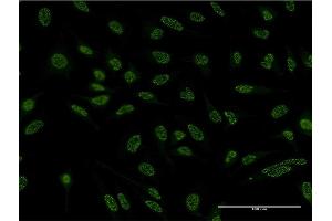 Immunofluorescence (IF) image for anti-B-Cell CLL/lymphoma 11A (Zinc Finger Protein) (BCL11A) (AA 1-88) antibody (ABIN526947)