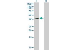 Western Blot analysis of FBXO28 expression in transfected 293T cell line by FBXO28 MaxPab polyclonal antibody. (FBXO28 抗体  (AA 1-368))